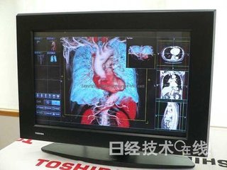 医用裸眼3D显示器，开始用于脑神经外科手术-磐众科技(广州)有限公司